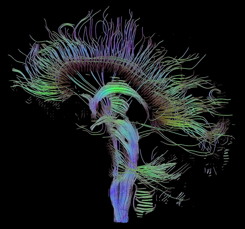 Reconstructed fiber tracts of a human brain, copyright Thomas Schulz.
